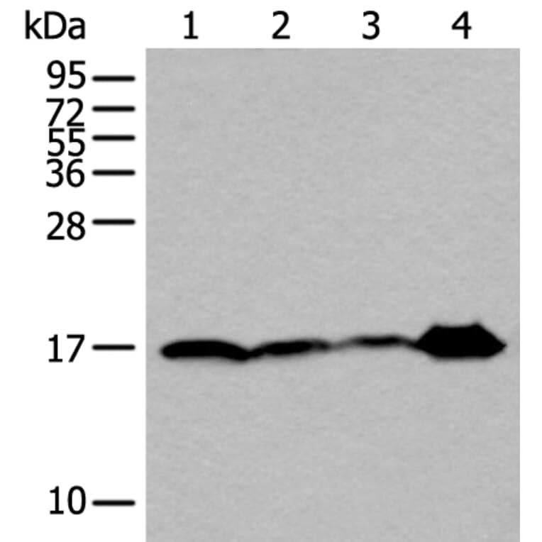 UBE2V2 Antibody from Signalway Antibody (43607) - Antibodies.com