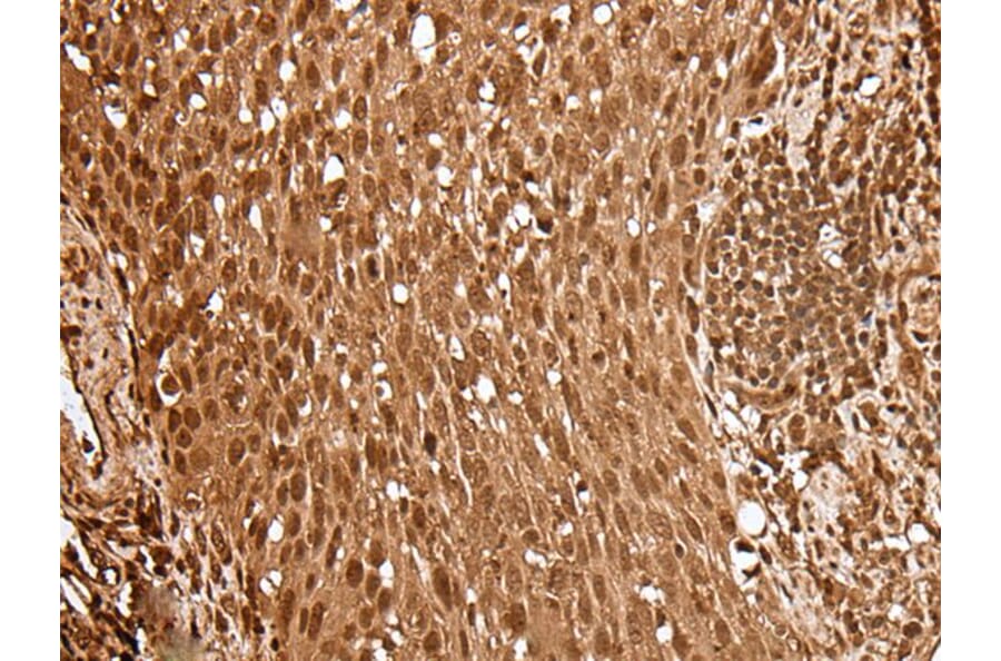 UBE2V2 Antibody from Signalway Antibody (43607) - Antibodies.com