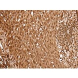 UBE2V2 Antibody from Signalway Antibody (43607) - Antibodies.com
