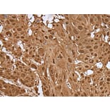 UBE2V2 Antibody from Signalway Antibody (43607) - Antibodies.com
