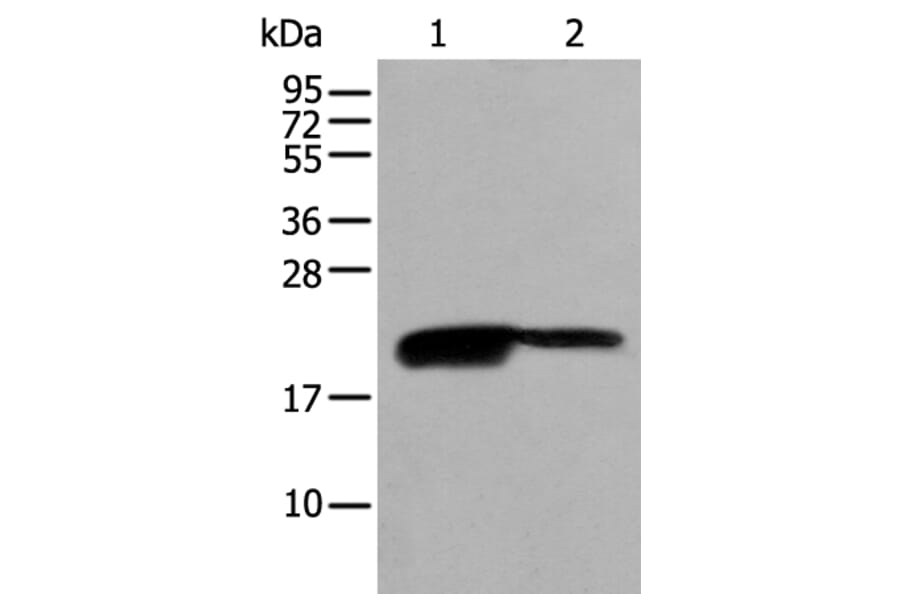 BRI3BP Antibody from Signalway Antibody (43694) - Antibodies.com