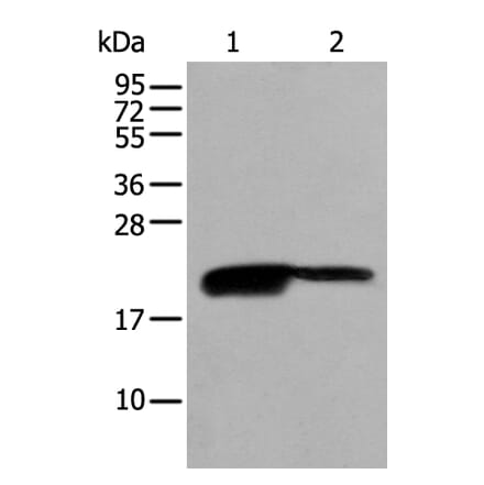 BRI3BP Antibody from Signalway Antibody (43694) - Antibodies.com