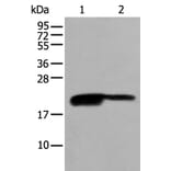 BRI3BP Antibody from Signalway Antibody (43694) - Antibodies.com