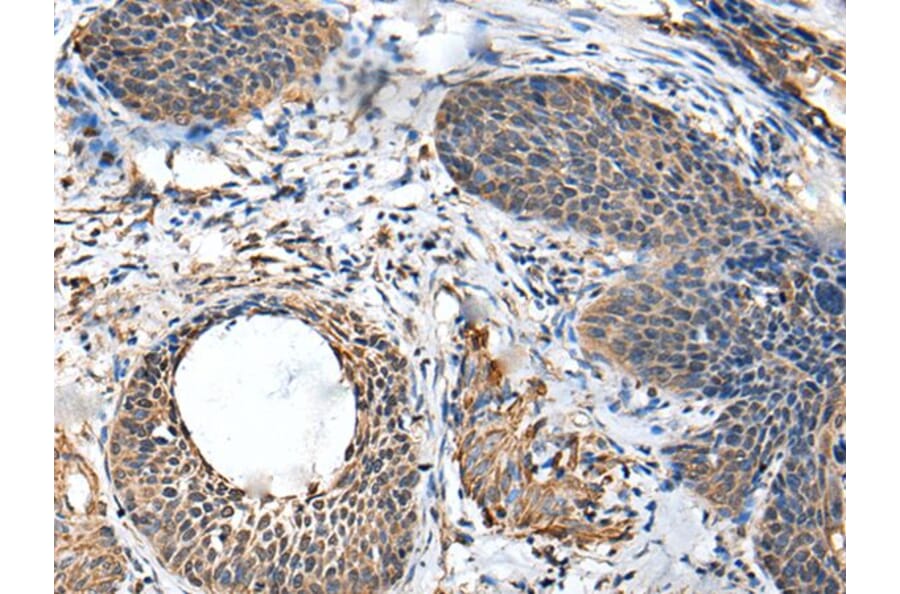 BRI3BP Antibody from Signalway Antibody (43694) - Antibodies.com