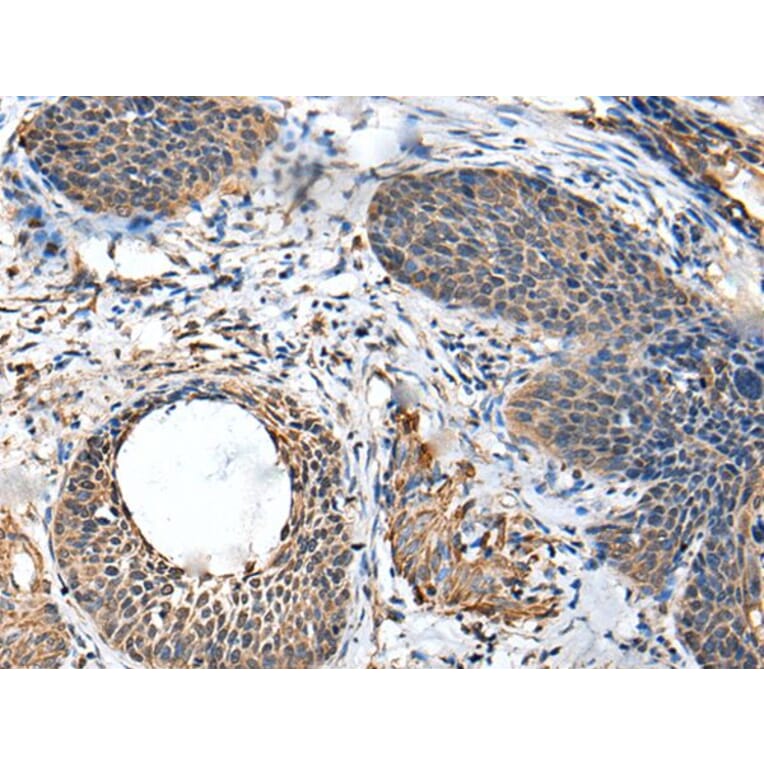 BRI3BP Antibody from Signalway Antibody (43694) - Antibodies.com