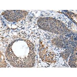 BRI3BP Antibody from Signalway Antibody (43694) - Antibodies.com