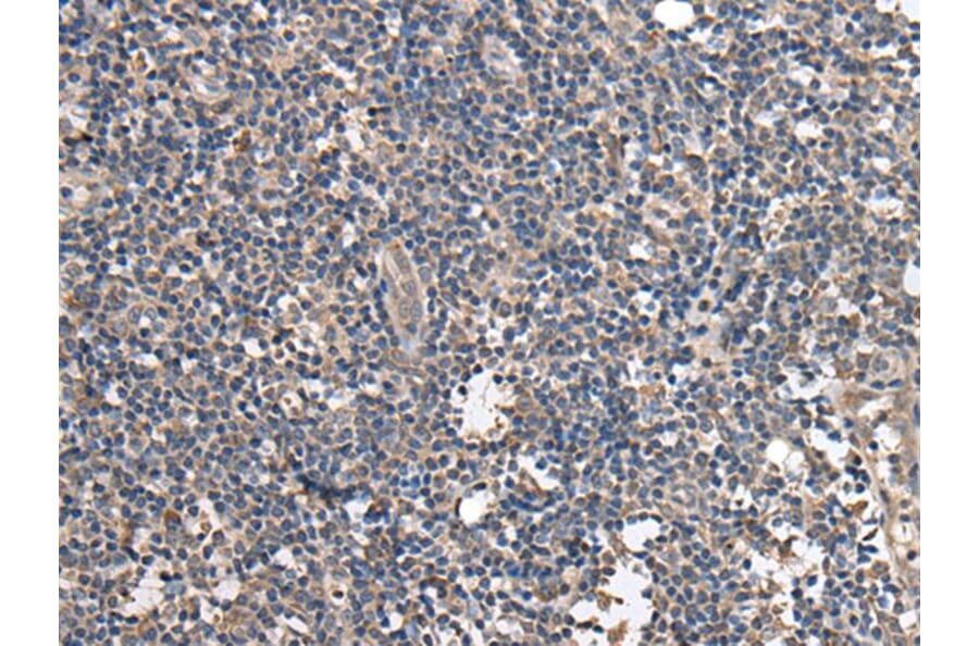 BRI3BP Antibody from Signalway Antibody (43694) - Antibodies.com