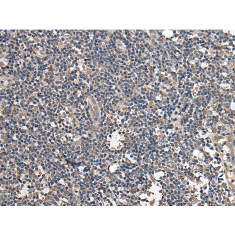 BRI3BP Antibody from Signalway Antibody (43694) - Antibodies.com