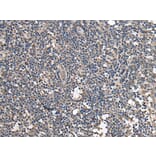 BRI3BP Antibody from Signalway Antibody (43694) - Antibodies.com