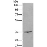 HOXD10 Antibody from Signalway Antibody (43732) - Antibodies.com