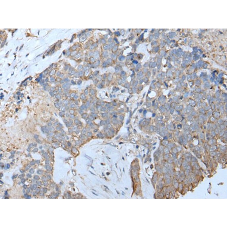 IFITM1 Antibody from Signalway Antibody (43734) - Antibodies.com