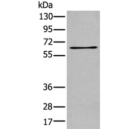 TCF7L1 Antibody from Signalway Antibody (43768) - Antibodies.com