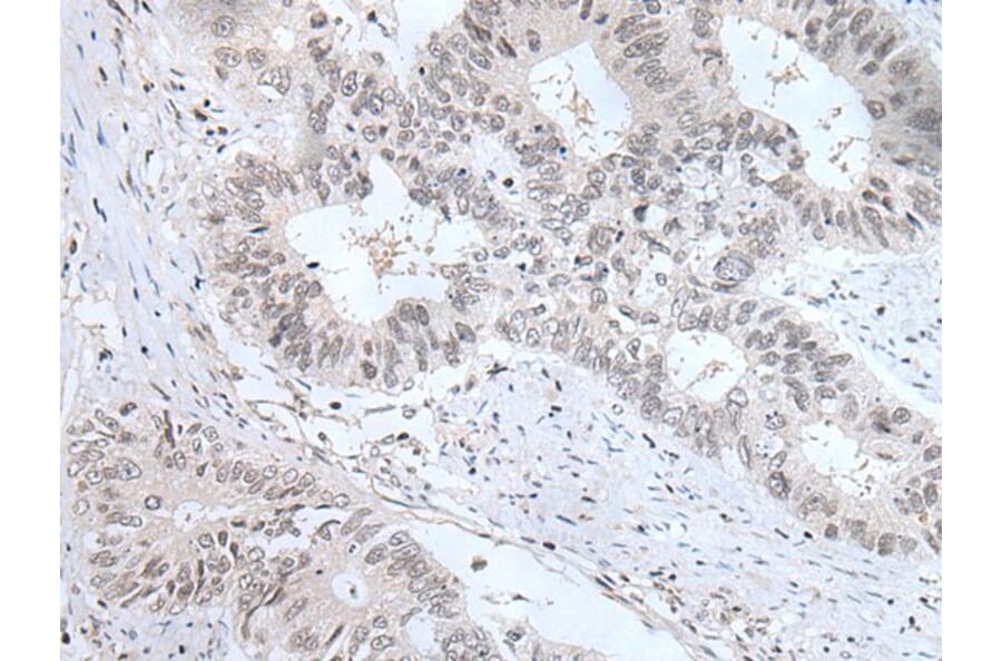 TCF7L1 Antibody from Signalway Antibody (43768) - Antibodies.com