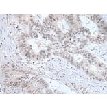 TCF7L1 Antibody from Signalway Antibody (43768) - Antibodies.com