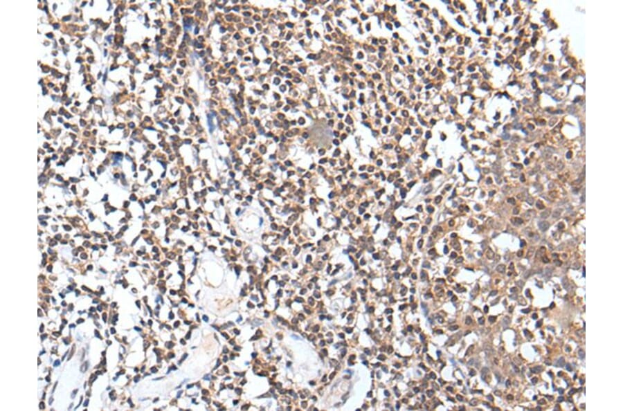 TCF7L1 Antibody from Signalway Antibody (43768) - Antibodies.com