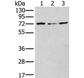 MTHFR Antibody from Signalway Antibody (43781) - Antibodies.com