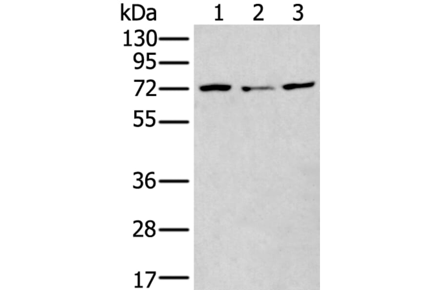MTHFR Antibody from Signalway Antibody (43781) - Antibodies.com