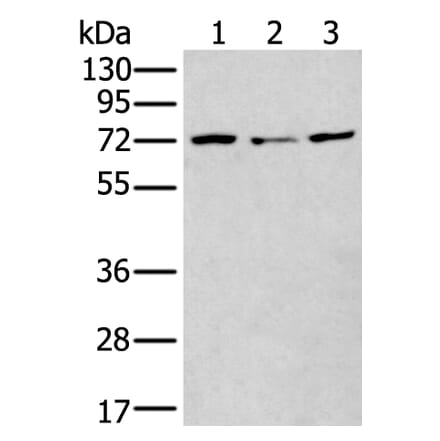 MTHFR Antibody from Signalway Antibody (43781) - Antibodies.com