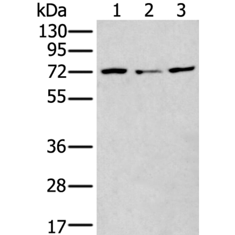 MTHFR Antibody from Signalway Antibody (43781) - Antibodies.com