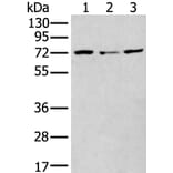 MTHFR Antibody from Signalway Antibody (43781) - Antibodies.com
