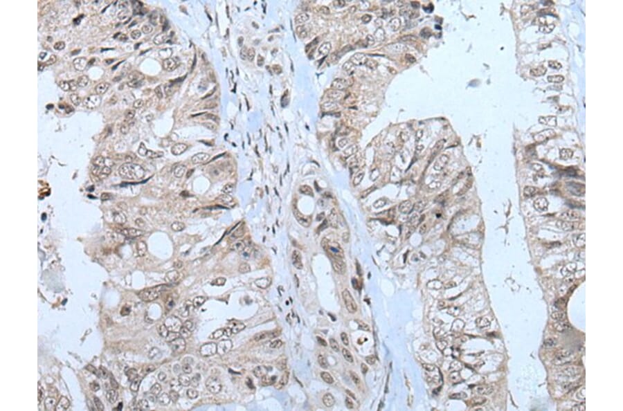MTHFR Antibody from Signalway Antibody (43781) - Antibodies.com
