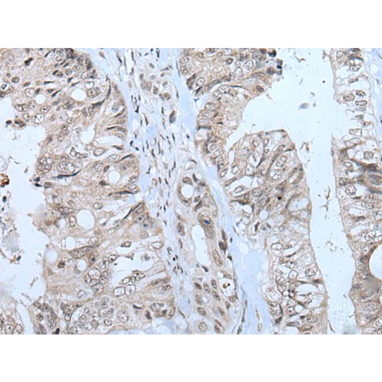 MTHFR Antibody from Signalway Antibody (43781) - Antibodies.com