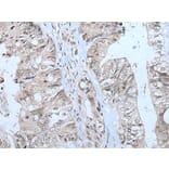 MTHFR Antibody from Signalway Antibody (43781) - Antibodies.com