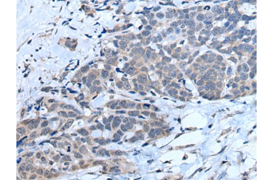 MTHFR Antibody from Signalway Antibody (43781) - Antibodies.com