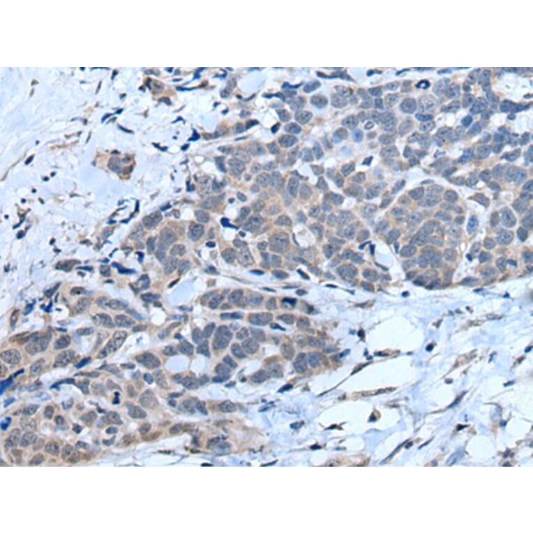 MTHFR Antibody from Signalway Antibody (43781) - Antibodies.com
