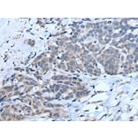 MTHFR Antibody from Signalway Antibody (43781) - Antibodies.com