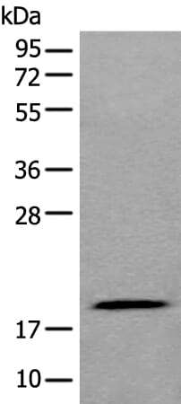 Gel: 12% SDS-PAGE Lysate: 40 &#956;g, Lane: 293T cell lysate , Primary antibody: ZNHIT1 antibody at dilution 1/400, Secondary antibody: Goat anti rabbit IgG at 1/8000 dilution, Exposure time: 30 seconds