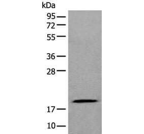 ZNHIT1 Antibody from Signalway Antibody (43881) - Antibodies.com