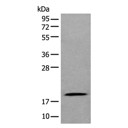 ZNHIT1 Antibody from Signalway Antibody (43881) - Antibodies.com