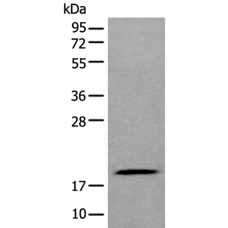 ZNHIT1 Antibody from Signalway Antibody (43881) - Antibodies.com