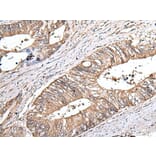 ZNHIT1 Antibody from Signalway Antibody (43881) - Antibodies.com