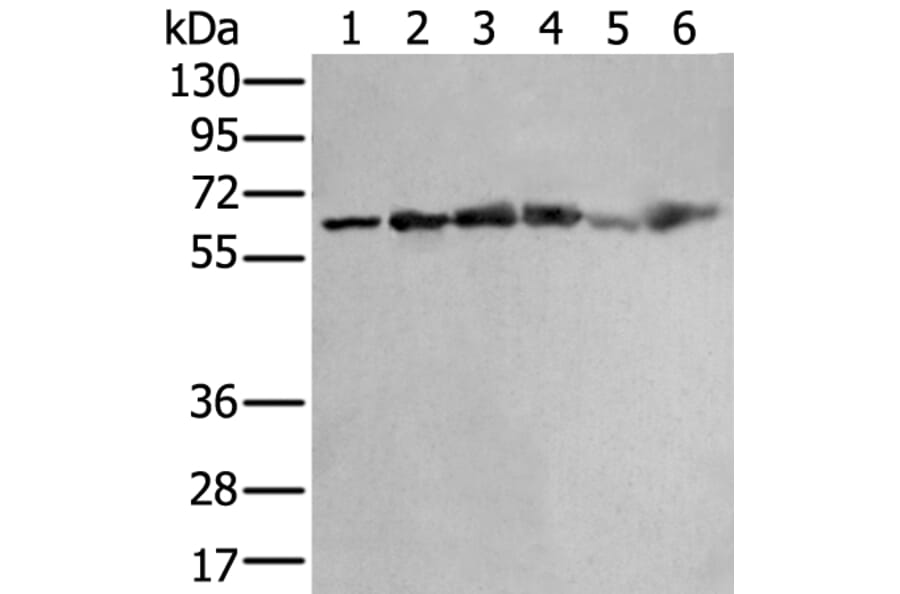 ZNF496 Antibody from Signalway Antibody (43890) - Antibodies.com