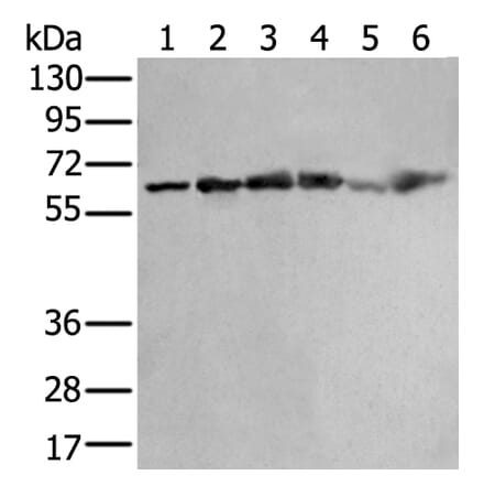 ZNF496 Antibody from Signalway Antibody (43890) - Antibodies.com
