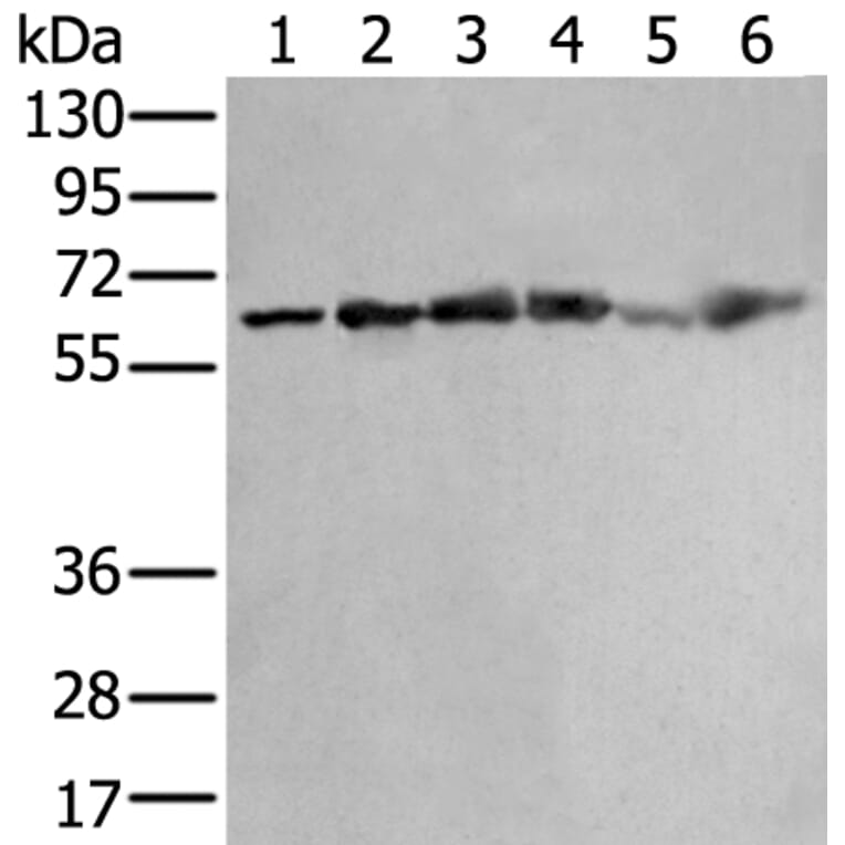 ZNF496 Antibody from Signalway Antibody (43890) - Antibodies.com