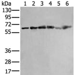 ZNF496 Antibody from Signalway Antibody (43890) - Antibodies.com