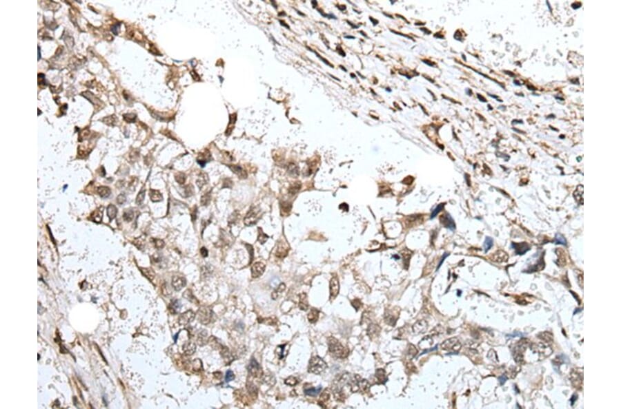 ZNF496 Antibody from Signalway Antibody (43890) - Antibodies.com