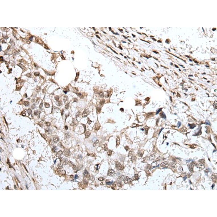 ZNF496 Antibody from Signalway Antibody (43890) - Antibodies.com