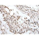 ZNF496 Antibody from Signalway Antibody (43890) - Antibodies.com