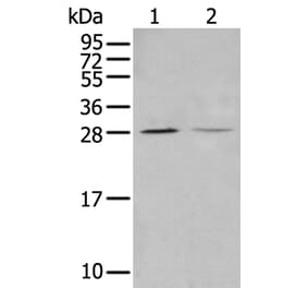 STARD4 Antibody from Signalway Antibody (43912) - Antibodies.com