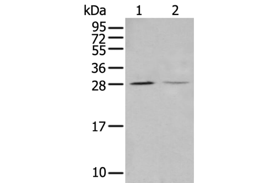 STARD4 Antibody from Signalway Antibody (43912) - Antibodies.com