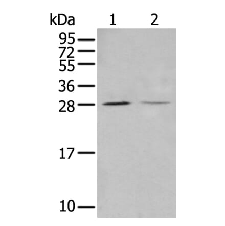 STARD4 Antibody from Signalway Antibody (43912) - Antibodies.com