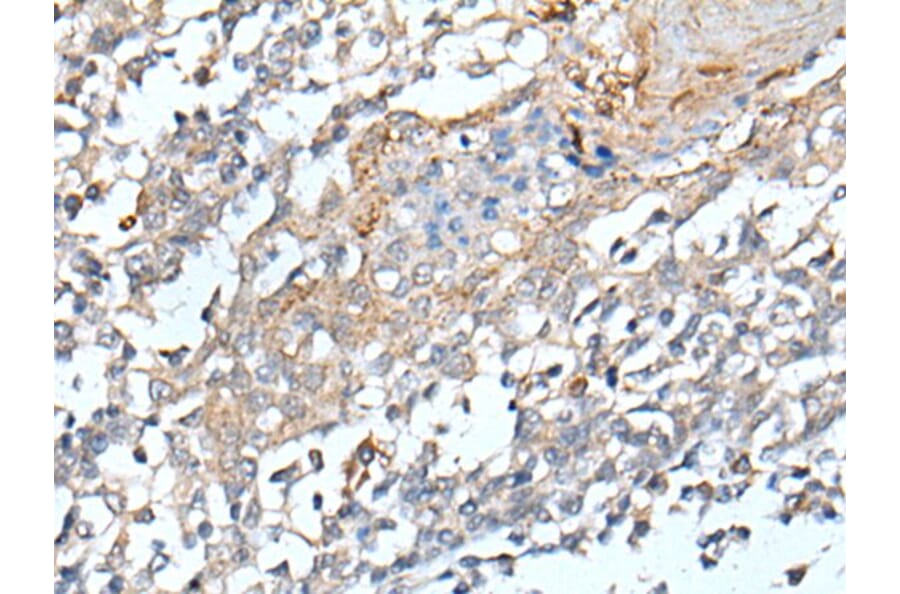 STARD4 Antibody from Signalway Antibody (43912) - Antibodies.com