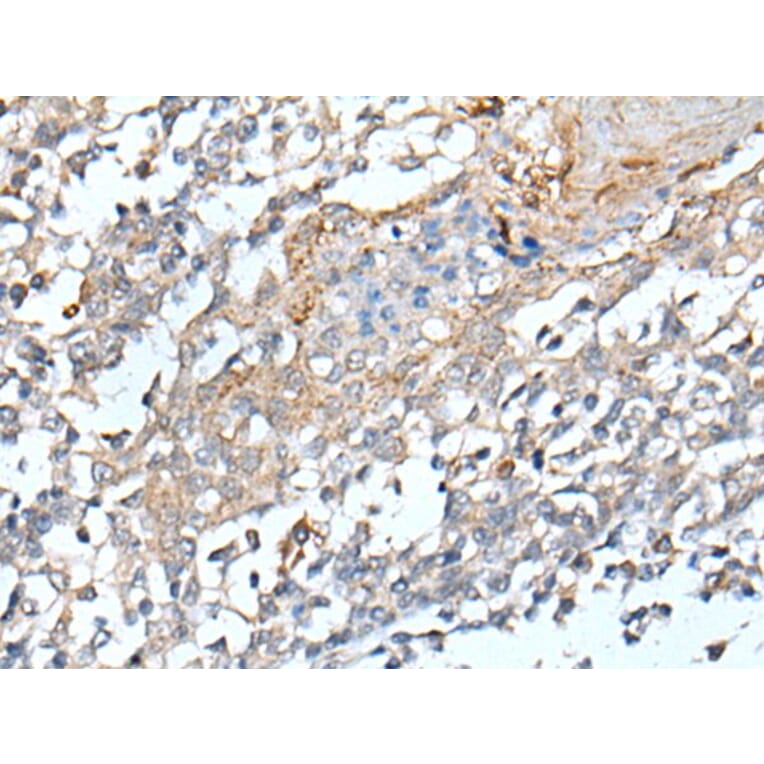 STARD4 Antibody from Signalway Antibody (43912) - Antibodies.com