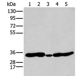 HOXC11 Antibody from Signalway Antibody (43932) - Antibodies.com