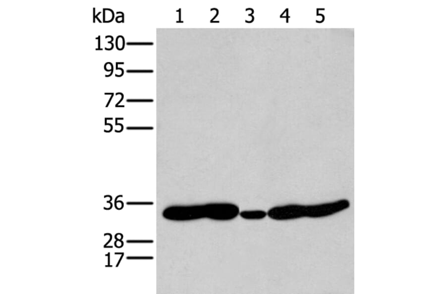 HOXC11 Antibody from Signalway Antibody (43932) - Antibodies.com