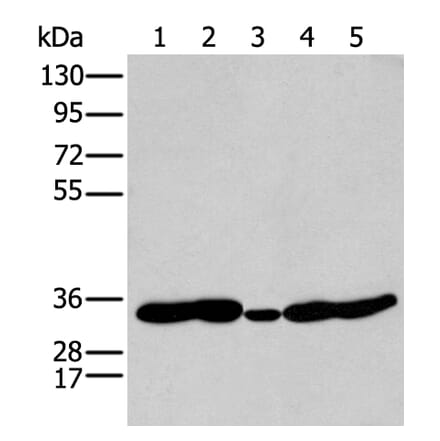 HOXC11 Antibody from Signalway Antibody (43932) - Antibodies.com